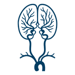 Neurovascular Intervention