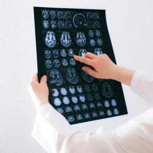 Acute Stroke Imaging & Workflow Optimization